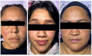 493b6e30a7bc4b68829ec4f2ab5c5472